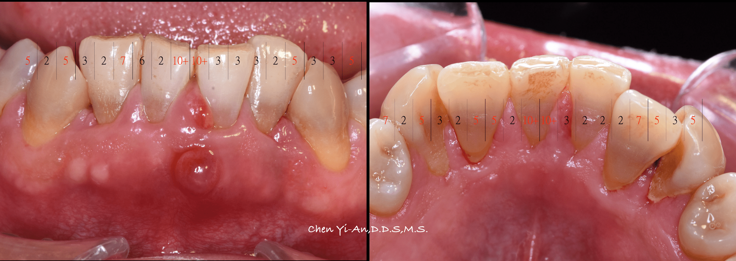螢幕快照 2017-10-09 下午10.14.57