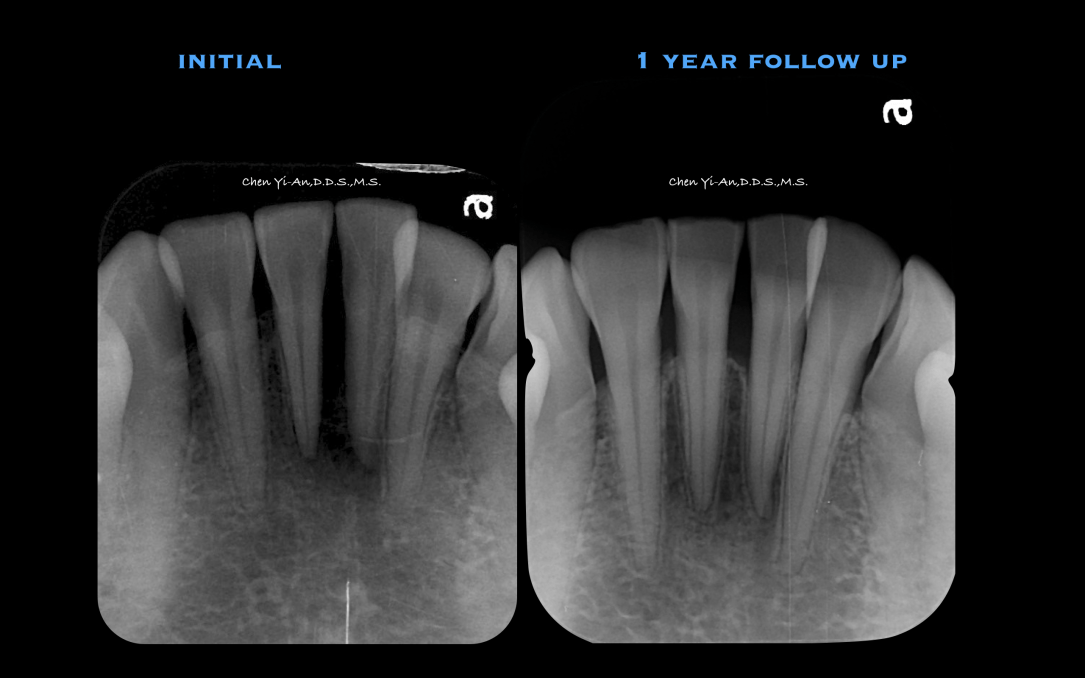螢幕快照 2018-03-18 上午12.16.34.png